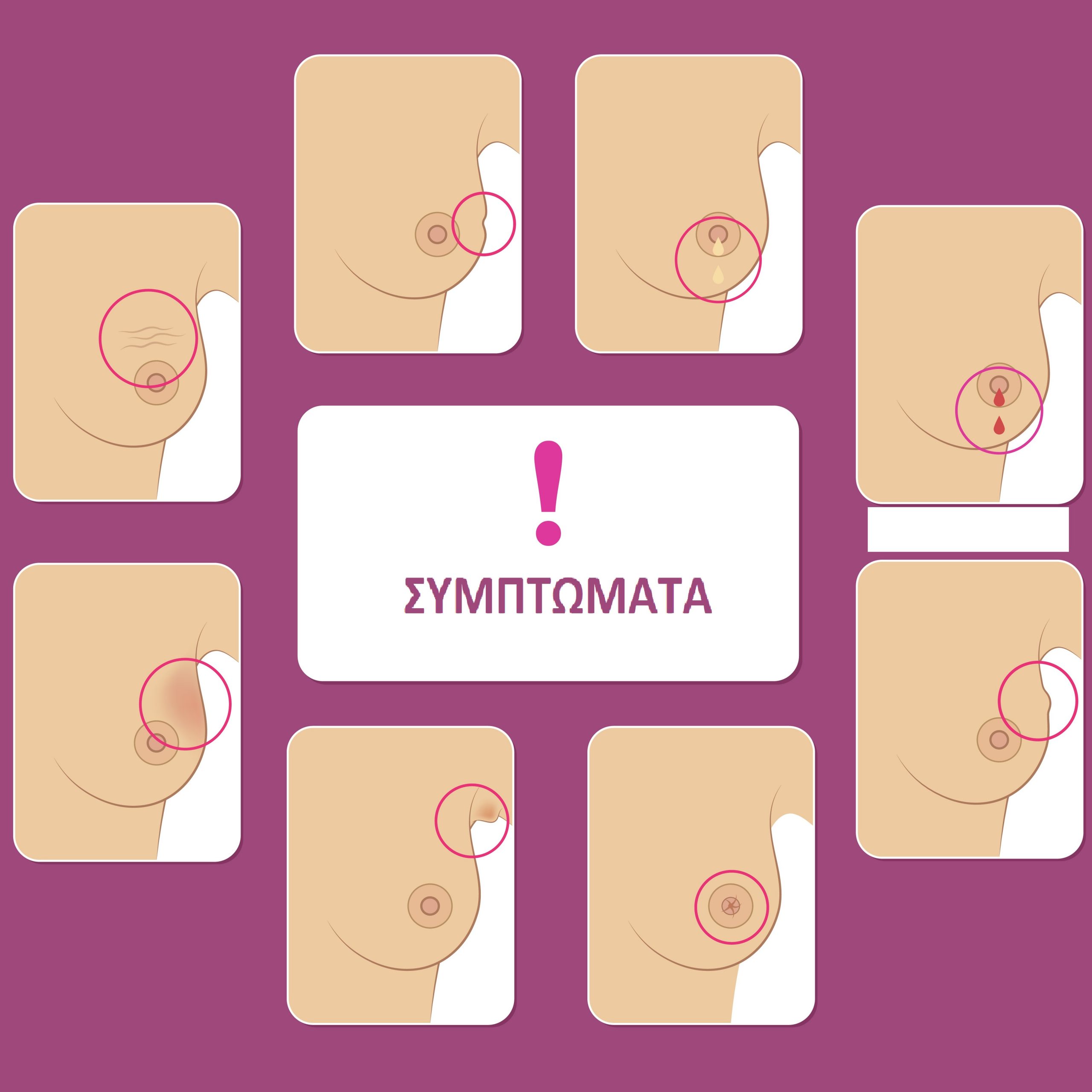 Συμπτώματα