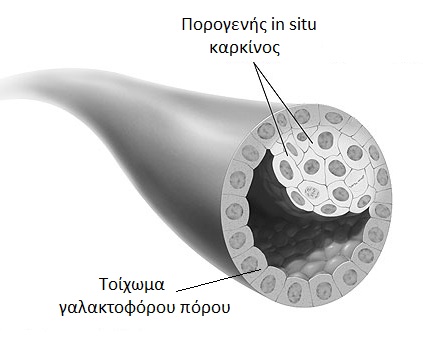 Πορογενής in situ