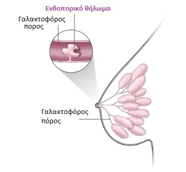 Δ1γ_Θήλωμα