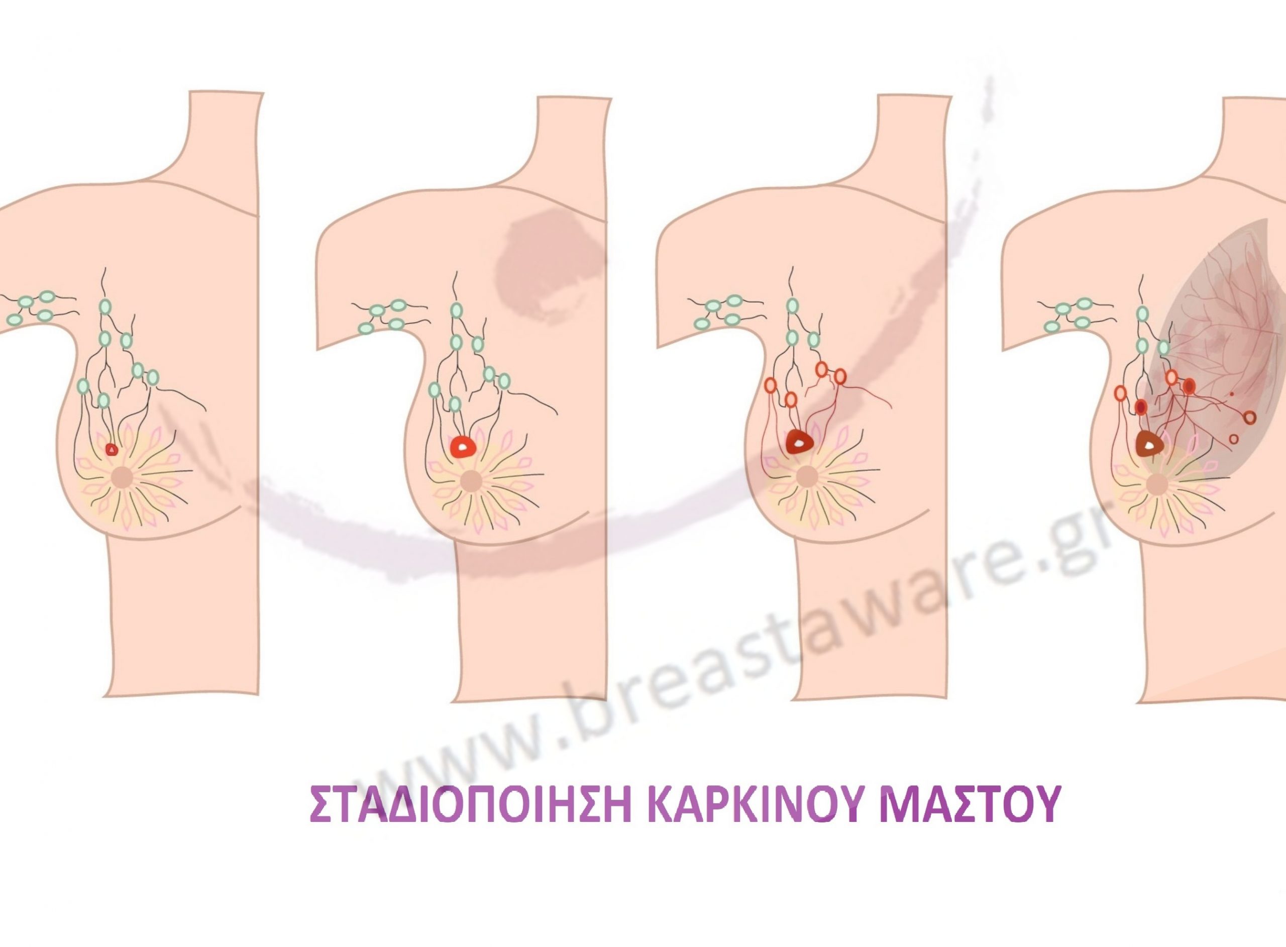 Ε6_Σταδιοποίηση